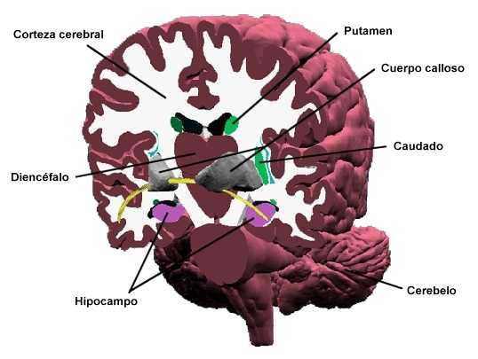 ¿Cómo funciona el cerebro? corte cerebro frontal2